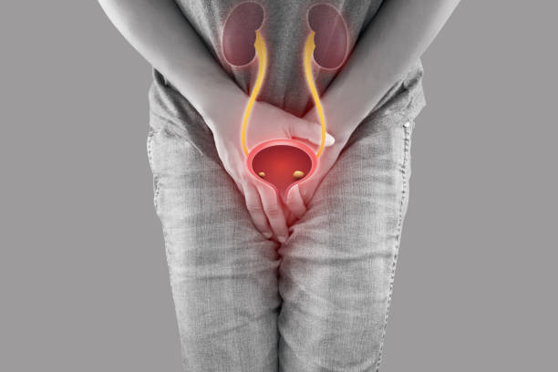 best urinary stone specialist in south mumbai